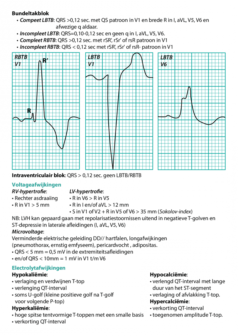 ecg-diagnostiek