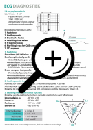 ecg-diagnostiek