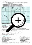 ecg-diagnostiek